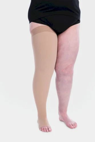 Compression Thigh-stocking
Several options available // Julius Zorn GmbH