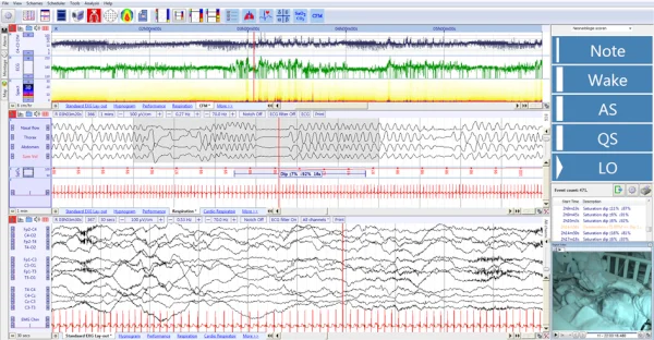 SleepER PSG Software for sleep acquisition and analysis.
